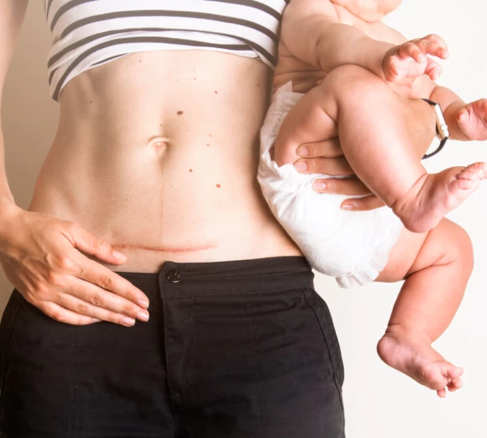 Sau sinh mổ bao lâu thì quan hệ tình dục được?